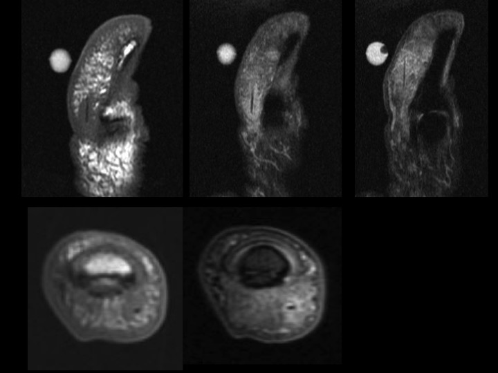 Figure 2 for case foreign body